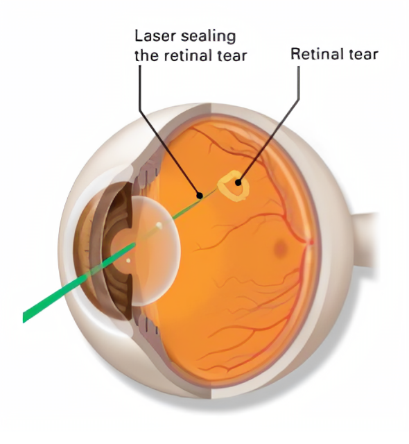 Anatomy of the Eye